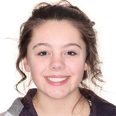 Young girl smiling with straight, evenly aligned teeth and a balanced, confident smile after orthodontic treatment.