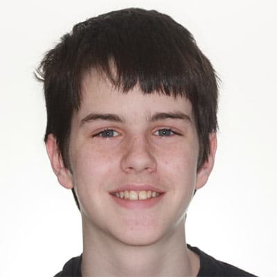 Teen smiling before treatment with mild crowding and uneven front tooth alignment.