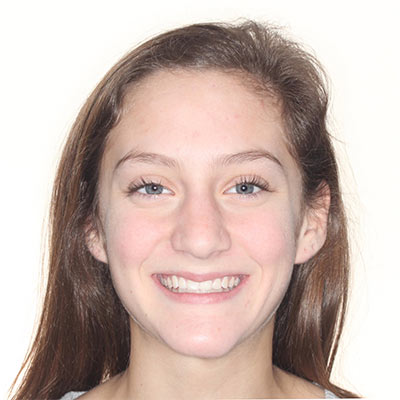 Teen smiling after treatment with straight, well-aligned teeth and a healthier, more balanced smile.