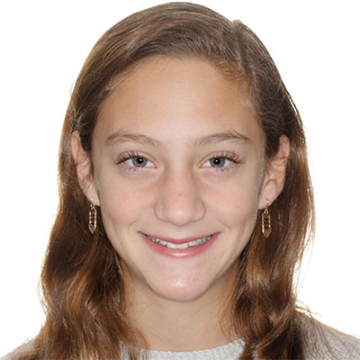 Teen smiling before treatment with mild crowding and uneven front tooth alignment.