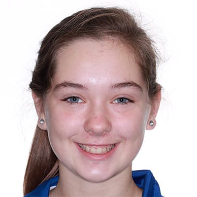 Teen smiling before treatment with mild spacing and uneven tooth alignment visible in the smile.
