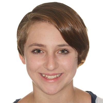 Smiling teen with slight spacing and uneven tooth alignment before orthodontic treatment.