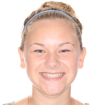 Smiling child with straight, evenly aligned teeth and an improved bite after smile transformation.