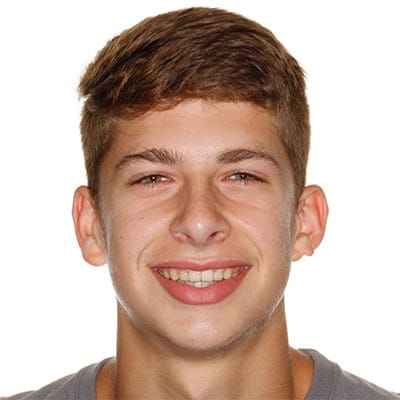 Patient after orthodontic treatment with a healthy, confident smile