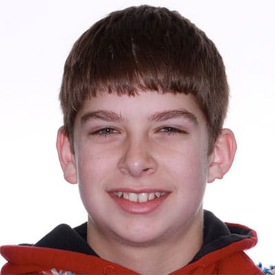 Patient before orthodontic treatment showing their smile prior to treatment